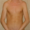 tightanus