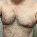 Nickebult