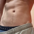 StartklarMed20cm
