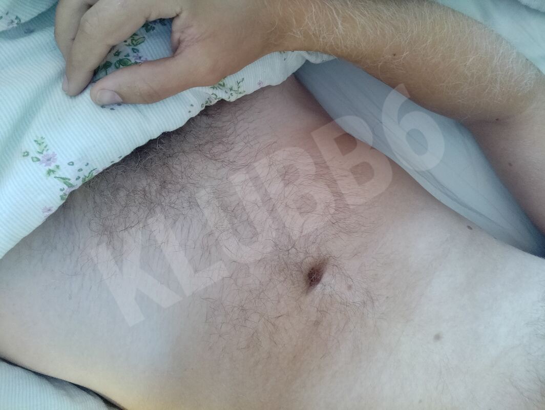 96llu025076779