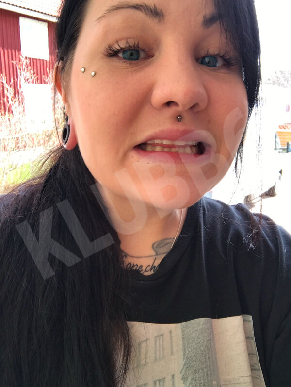 Fosterskadad35214946