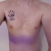 norrk38