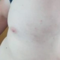 Storsorutaren78