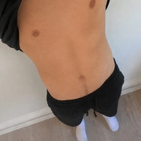 Essett
