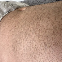 Adam300