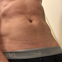 Ochpp28