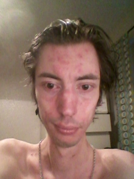 torsken