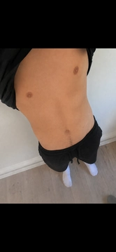 Essett