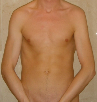 tightanus