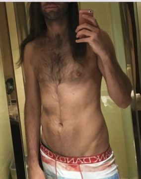 thomyorke79