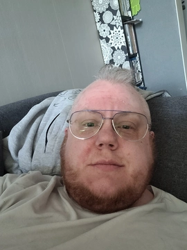 Skonetosen81